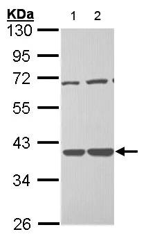 Western blot - Anti-TSTA3 antibody (AB155306)