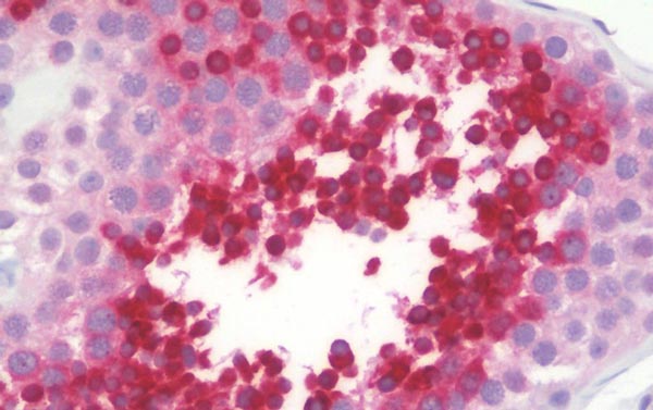 Immunohistochemistry (Formalin/PFA-fixed paraffin-embedded sections) - Anti-TSTA3 antibody (AB190002)