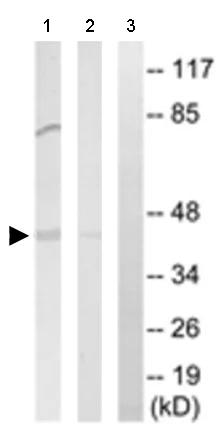 Western blot - Anti-TSTA3 antibody (AB190002)