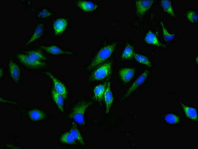 Immunocytochemistry/ Immunofluorescence - Anti-TTC11/FIS1 antibody (AB229969)