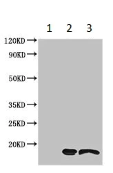 Immunoprecipitation - Anti-TTC11/FIS1 antibody (AB229969)
