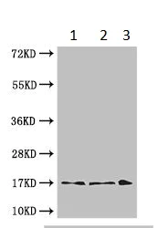 Western blot - Anti-TTC11/FIS1 antibody (AB229969)