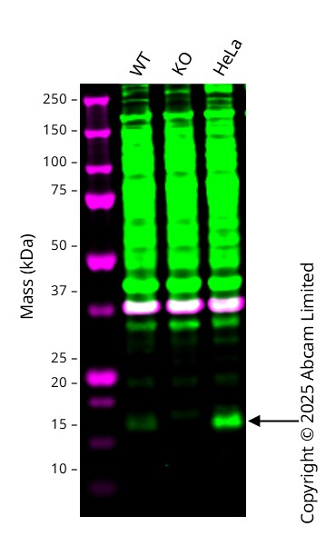 Western blot - Anti-TTC11/FIS1 antibody (AB229969)