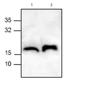 Western blot - Anti-TTC11/FIS1 antibody (AB71498)