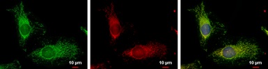 Immunocytochemistry/ Immunofluorescence - Anti-TTC11/FIS1 antibody (AB96764)