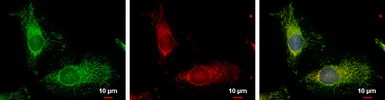 Immunocytochemistry/ Immunofluorescence - Anti-TTC11/FIS1 antibody (AB96764)