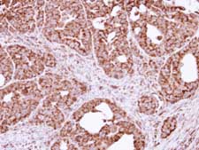 Immunohistochemistry (Formalin/PFA-fixed paraffin-embedded sections) - Anti-TTC11/FIS1 antibody (AB96764), expandable thumbnail