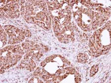 Immunohistochemistry (Formalin/PFA-fixed paraffin-embedded sections) - Anti-TTC11/FIS1 antibody (AB96764)