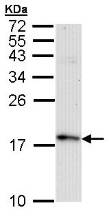 Western blot - Anti-TTC11/FIS1 antibody (AB96764), expandable thumbnail