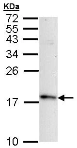 Western blot - Anti-TTC11/FIS1 antibody (AB96764)