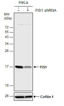 Western blot - Anti-TTC11/FIS1 antibody (AB96764)