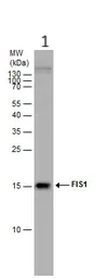 Western blot - Anti-TTC11/FIS1 antibody (AB96764)