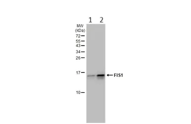 Western blot - Anti-TTC11/FIS1 antibody (AB96764)