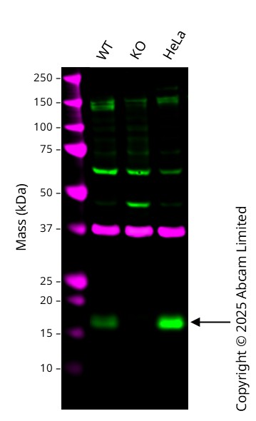 Western blot - Anti-TTC11/FIS1 antibody [EPR8412] (AB156865)