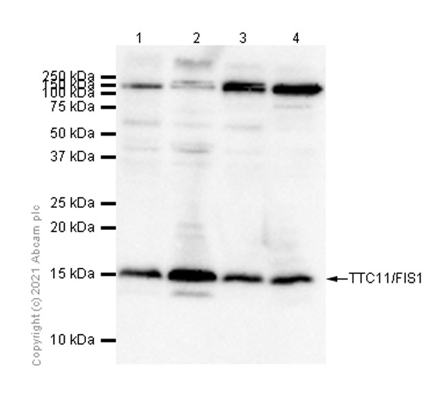 Western blot - Anti-TTC11/FIS1 antibody [EPR8412] - BSA and Azide free (AB238929), expandable thumbnail