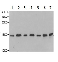 Western blot - Anti-TTC11/FIS1 antibody - N-terminal (AB189846)