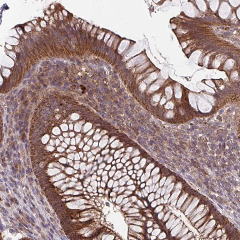 Immunohistochemistry (Formalin/PFA-fixed paraffin-embedded sections) - Anti-TTC19 antibody (AB204236)