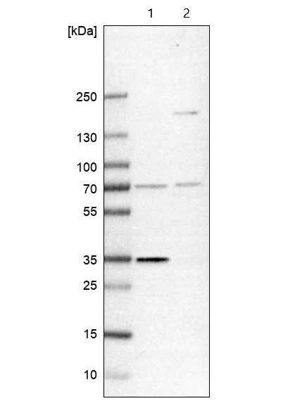 Western blot - Anti-TTC19 antibody (AB204236)