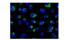 Immunocytochemistry/ Immunofluorescence - Anti-TTC19 antibody [EPR13184-63] (AB181191), expandable thumbnail