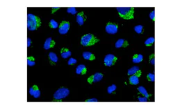 Immunocytochemistry/ Immunofluorescence - Anti-TTC19 antibody [EPR13184-63] (AB181191)