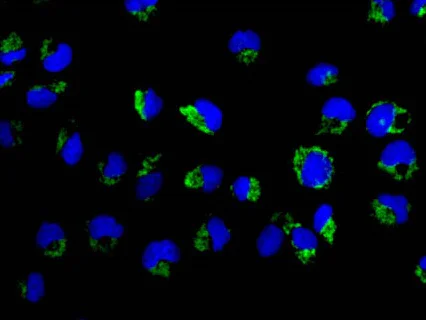 Immunocytochemistry/ Immunofluorescence - Anti-TTC19 antibody [EPR13184] - BSA and Azide free (AB250323)