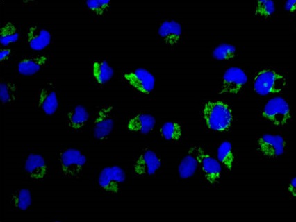 Immunocytochemistry/ Immunofluorescence - Anti-TTC19 antibody [EPR13184] - C-terminal (AB181069)