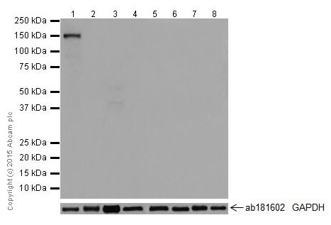Western blot - Anti-TTC21A/STI2 antibody [EPR17437] (AB201229), expandable thumbnail