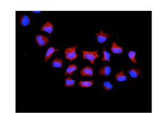 Immunocytochemistry/ Immunofluorescence - Anti-TTC27 antibody [EPR13653] (AB181162)