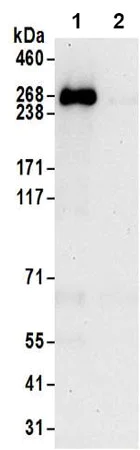 Immunoprecipitation - Anti-TTC28/TPRBK antibody - C-terminal (AB197076)