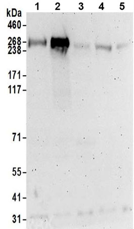 Western blot - Anti-TTC28/TPRBK antibody - C-terminal (AB197076)