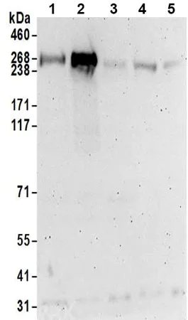 Western blot - Anti-TTC28/TPRBK antibody - C-terminal (AB197076)