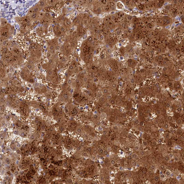 Immunohistochemistry (Formalin/PFA-fixed paraffin-embedded sections) - Anti-TTC36 antibody (AB122507)