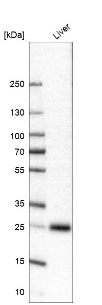 Western blot - Anti-TTC36 antibody (AB122507)