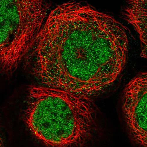 Immunocytochemistry/ Immunofluorescence - Anti-TTC37 antibody (AB122421)