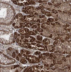 Immunohistochemistry (Formalin/PFA-fixed paraffin-embedded sections) - Anti-TTC37 antibody (AB122421)