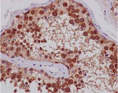 Immunohistochemistry (Formalin/PFA-fixed paraffin-embedded sections) - Anti-TTC4 antibody [EPR13381-76] (AB181195), expandable thumbnail