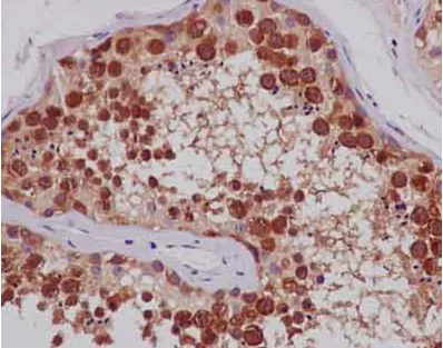 Immunohistochemistry (Formalin/PFA-fixed paraffin-embedded sections) - Anti-TTC4 antibody [EPR13381-76] - BSA and Azide free (AB250418)