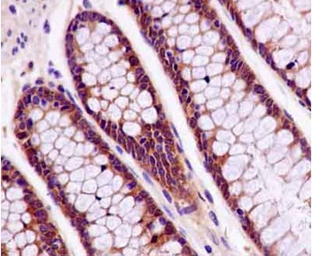Immunohistochemistry (Formalin/PFA-fixed paraffin-embedded sections) - Anti-TTC4 antibody [EPR13381] (AB181194)