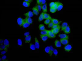 Immunocytochemistry/ Immunofluorescence - Anti-TTC4 antibody [EPR13381] - BSA and Azide free (AB250417)