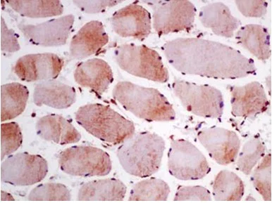 Immunohistochemistry (Formalin/PFA-fixed paraffin-embedded sections) - Anti-TTC4 antibody [EPR13381] - BSA and Azide free (AB250417)