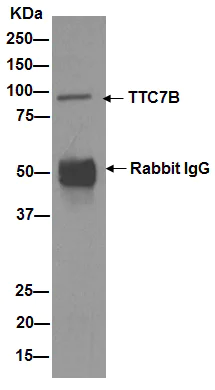 Immunoprecipitation - Anti-TTC7B antibody [EPR15995] (AB193361)