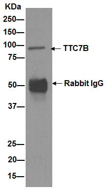Immunoprecipitation - Anti-TTC7B antibody [EPR15995] - BSA and Azide free (AB251172), expandable thumbnail