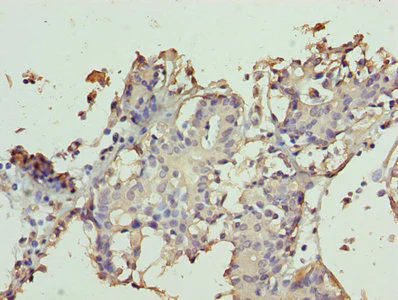 Immunohistochemistry (Formalin/PFA-fixed paraffin-embedded sections) - Anti-TTC9C antibody (AB235537)
