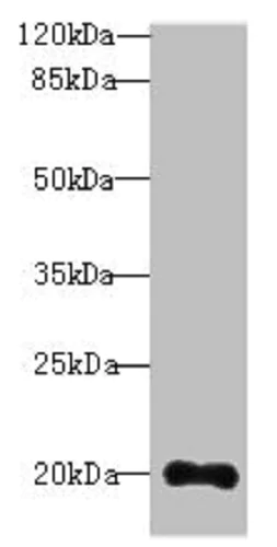 Western blot - Anti-TTC9C antibody (AB235537)