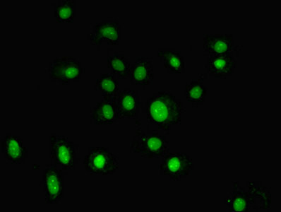 Immunocytochemistry/ Immunofluorescence - Anti-TTDA antibody (AB238855)