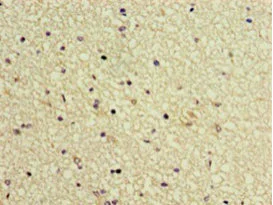 Immunohistochemistry (Formalin/PFA-fixed paraffin-embedded sections) - Anti-TTDA antibody (AB238855)