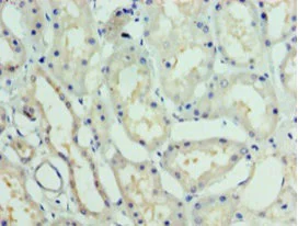 Immunohistochemistry (Formalin/PFA-fixed paraffin-embedded sections) - Anti-TTDA antibody (AB238855)