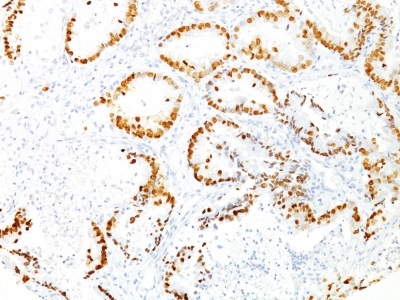 Immunohistochemistry (Formalin/PFA-fixed paraffin-embedded sections) - Anti-TTF1/Nkx2-1 antibody [8G7G3/1] (AB233977), expandable thumbnail