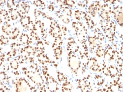 Immunohistochemistry (Formalin/PFA-fixed paraffin-embedded sections) - Anti-TTF1/Nkx2-1 antibody [8G7G3/1] (AB233977), expandable thumbnail