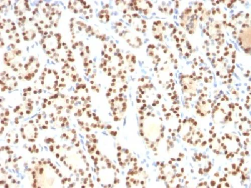 Immunohistochemistry (Formalin/PFA-fixed paraffin-embedded sections) - Anti-TTF1/Nkx2-1 antibody [8G7G3/1] - BSA and Azide free (AB212886)